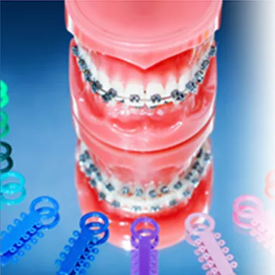 Ortodonzia intercettiva per i bambini e ortodonzia fissa negli adulti